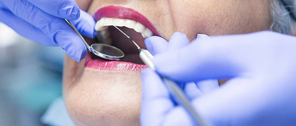 Best Pediatric Emergency Dentist in South San Gabriel, CA